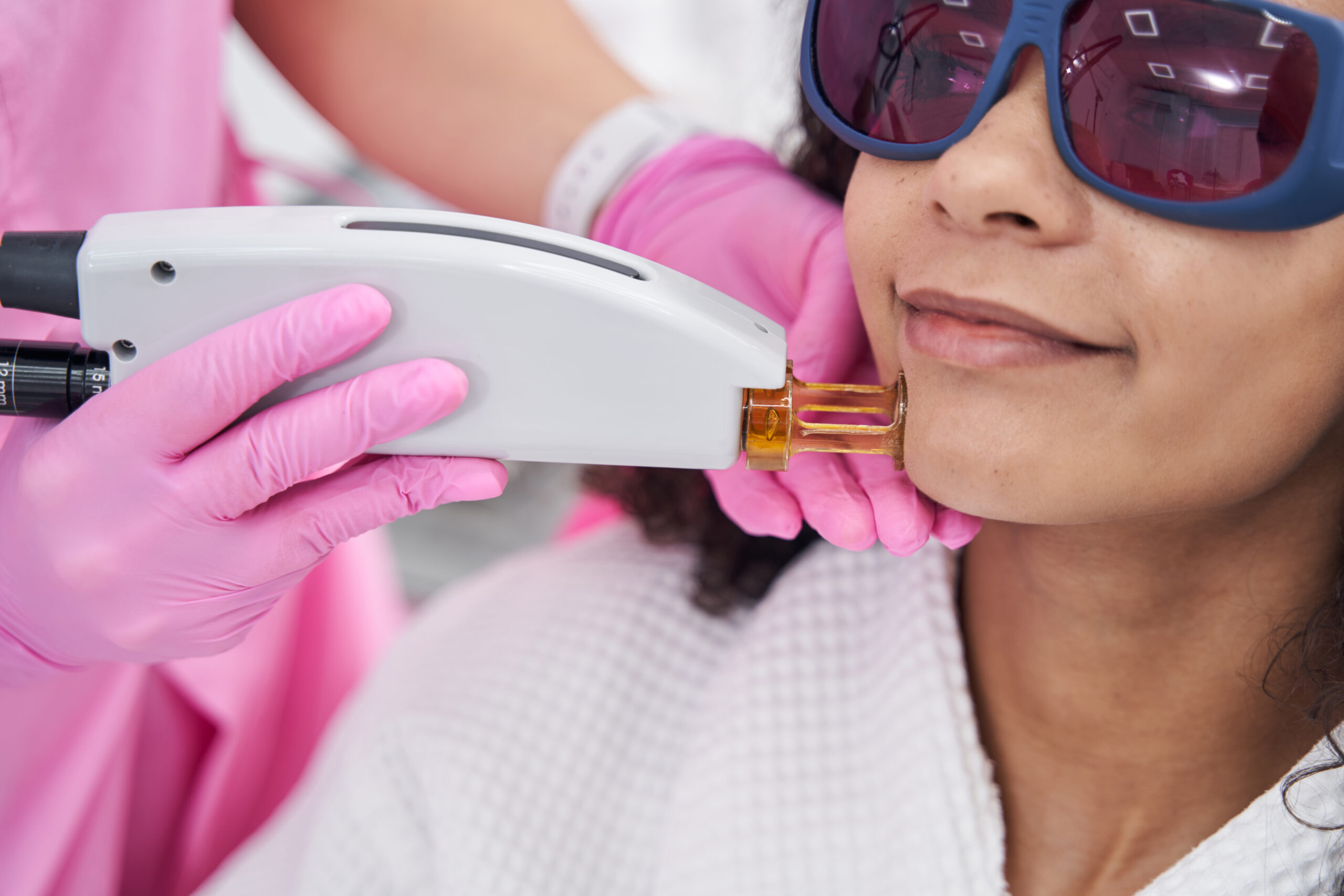 Smiling woman in protective glasses sitting while beautician undergoing hair removal on lower part of face